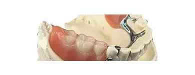 Business 5 image LONDONDERRY DENTURE CLINIC Health & Medicine in Edmonton AB