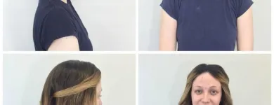 Entreprises 17 image PACIFIC HAIR LOSS SOLUTIONS Wigs & Hairpieces dans Vancouver BC