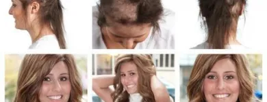 Entreprises 1 image PACIFIC HAIR LOSS SOLUTIONS Wigs & Hairpieces dans Vancouver BC