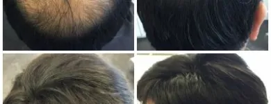 Entreprises 20 image PACIFIC HAIR LOSS SOLUTIONS Wigs & Hairpieces dans Vancouver BC