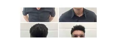 Entreprises 32 image PACIFIC HAIR LOSS SOLUTIONS Wigs & Hairpieces dans Vancouver BC