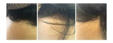 Entreprises 38 image PACIFIC HAIR LOSS SOLUTIONS Wigs & Hairpieces dans Vancouver BC