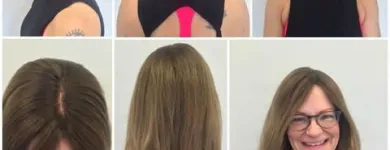 Entreprises 4 image PACIFIC HAIR LOSS SOLUTIONS Wigs & Hairpieces dans Vancouver BC