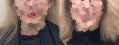 Entreprises 41 image PACIFIC HAIR LOSS SOLUTIONS Wigs & Hairpieces dans Vancouver BC