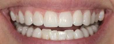 Business 4 image PHELAN DENTAL Dentists in Oakville ON