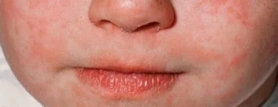 Entreprises 1 image REMEDY'SRX - CHARLOTTE CARE PHARMACY Pharmacies dans Peterborough ON