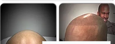 Business 1 image SCALP MICROPIGMENTATION TRAINING CENTER Health & Medicine in Toronto ON