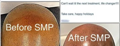 Business 9 image SCALP MICROPIGMENTATION TRAINING CENTER Health & Medicine in Toronto ON