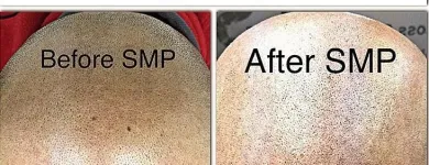 Business 13 image SCALP MICROPIGMENTATION TRAINING CENTER Health & Medicine in Toronto ON