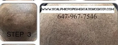 Business 18 image SCALP MICROPIGMENTATION TRAINING CENTER Health & Medicine in Toronto ON