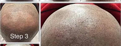 Business 2 image SCALP MICROPIGMENTATION TRAINING CENTER Health & Medicine in Toronto ON