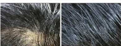 Business 3 image SCALP MICROPIGMENTATION TRAINING CENTER Health & Medicine in Toronto ON