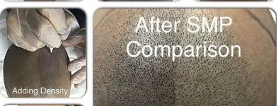 Business 4 image SCALP MICROPIGMENTATION TRAINING CENTER Health & Medicine in Toronto ON