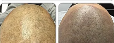 Business 20 image SCALP MICROPIGMENTATION TRAINING CENTER Health & Medicine in Toronto ON