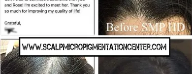 Business 21 image SCALP MICROPIGMENTATION TRAINING CENTER Health & Medicine in Toronto ON