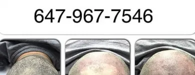 Business 26 image SCALP MICROPIGMENTATION TRAINING CENTER Health & Medicine in Toronto ON