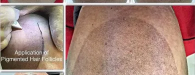 Business 27 image SCALP MICROPIGMENTATION TRAINING CENTER Health & Medicine in Toronto ON