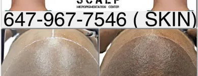 Business 6 image SCALP MICROPIGMENTATION TRAINING CENTER Health & Medicine in Toronto ON