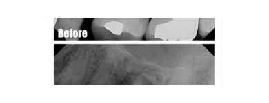 Entreprises 6 image SIMON FRASER DENTAL CENTRE Health & Medicine dans Burnaby BC