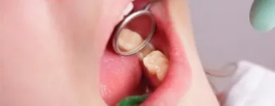 Entreprises 8 image SIMON FRASER DENTAL CENTRE Health & Medicine dans Burnaby BC