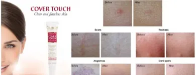 Entreprises 28 image SKIN CARE TORONTO Skin Care Clinics & Services dans North York ON