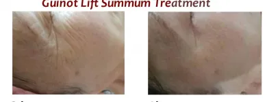 Entreprises 3 image SKIN CARE TORONTO Skin Care Clinics & Services dans North York ON