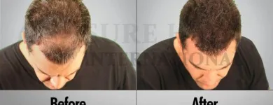 Business 6 image SURE HAIR INTERNATIONAL Hair Loss Treatments & Clinics in Toronto ON
