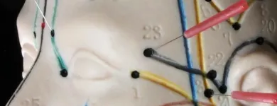 Business 2 image THE PACIFIC WELLNESS INSTITUTE Shiatsu Therapists in Toronto ON