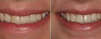 Business 11 image WEST VAUGHAN DENTAL Orthodontists in Woodbridge ON
