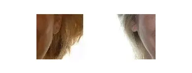 Business 8 image WHISTLER ORTHODONTIC CENTER Orthodontists in Whistler BC