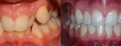 Business 1 image WHISTLER ORTHODONTIC CENTER Orthodontists in Whistler BC