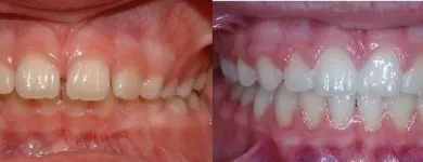 Business 2 image WHISTLER ORTHODONTIC CENTER Orthodontists in Whistler BC