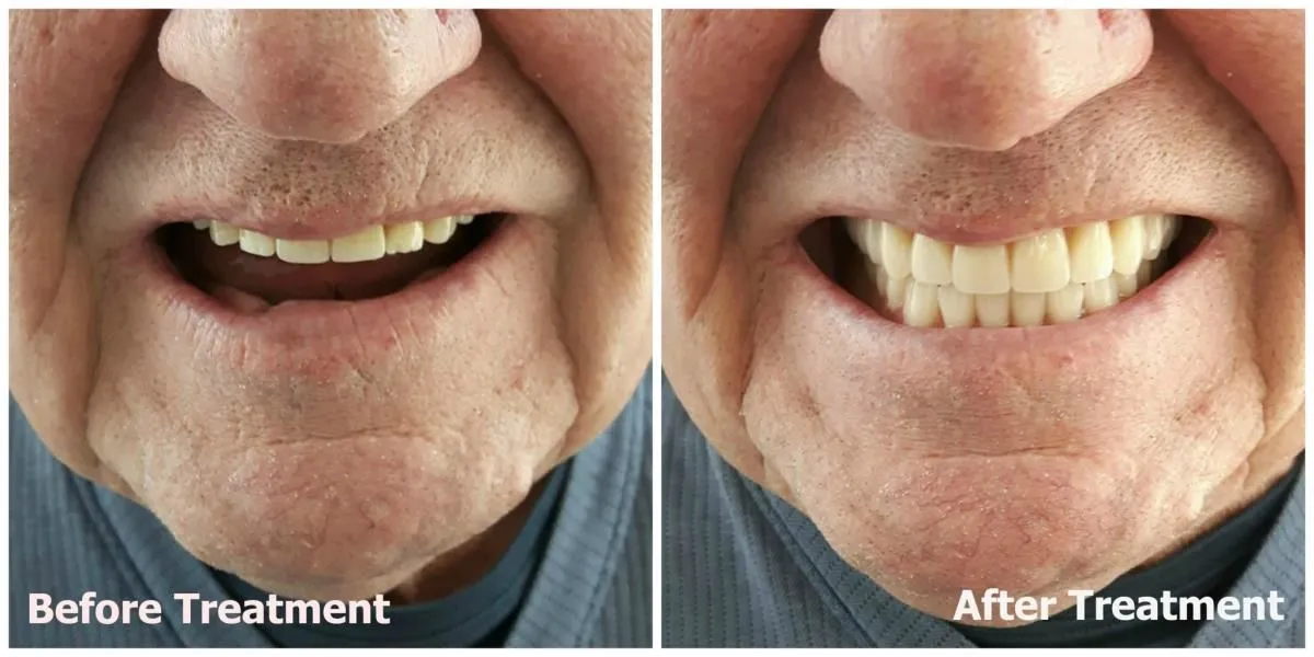 Business 2 image KELOWNA DENTURE CLINIC