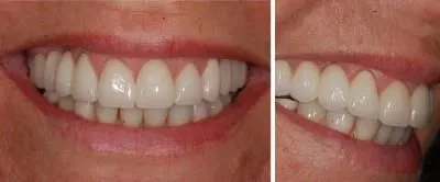 Entreprises 2 image CARLETON CAB