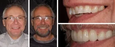 Entreprises 3 image CARLETON CAB