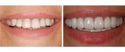 Entreprises 4 image CARLETON CAB