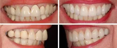 Entreprises 5 image CARLETON CAB